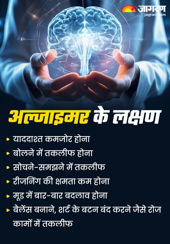 Alzheimer's prevention tips